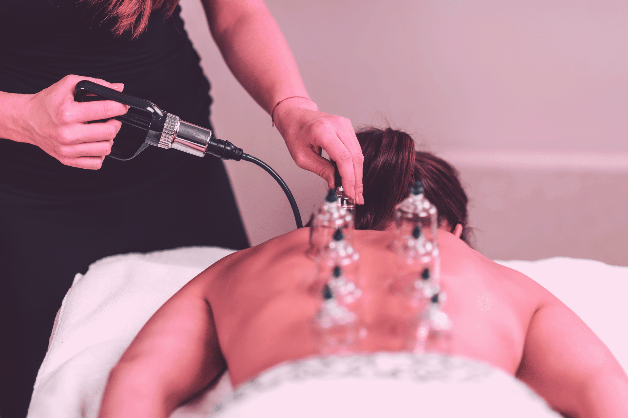 Cupping massage